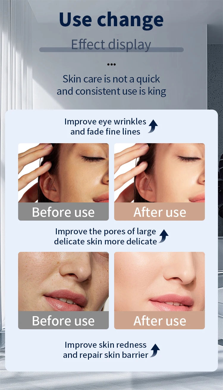 Skyntra™ Radiance Mask