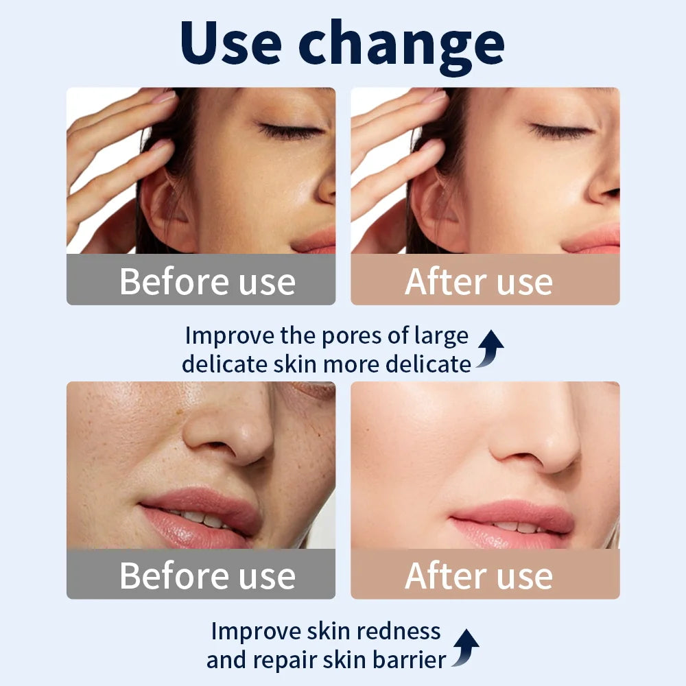 Skyntra™ Radiance Mask