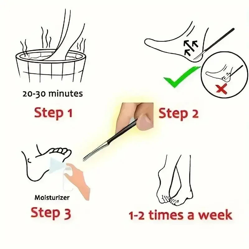 1Pc Pedicure Knife Tools Kits Professional Stainless Steel Foot Scrubber Dead Skin Remover Foot Scraper Knife Foot Care Tool New