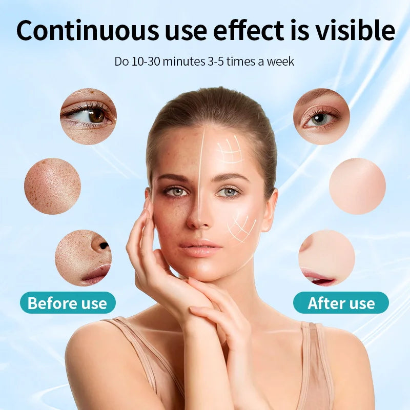 Skyntra™ Radiance Mask